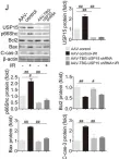 Fig.5.J showing Western Blotting from the publication: USP15 regulates p66Shc stability associated with Drp1 activation in liver ischemia/reperfusion.