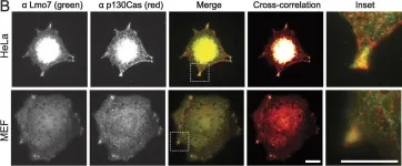 Fig.3.B showing Immunocytochemistry-immunofluorescence in a Homo sapiens (Human) sample from the publication: The emerin-binding transcription factor Lmo7 is regulated by association with p130Cas at focal adhesions.