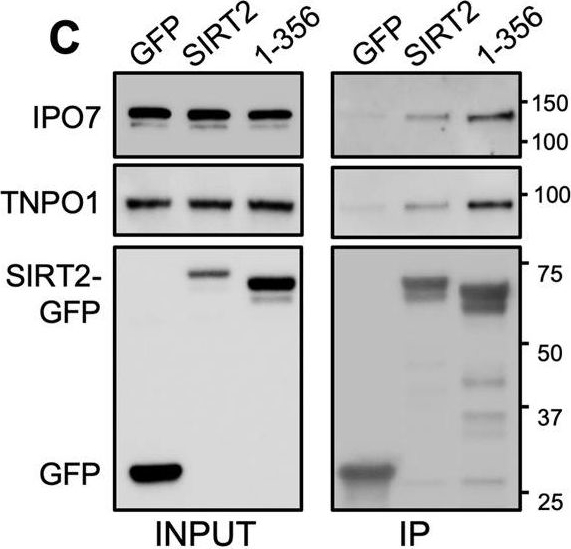 Fig.4.C showing Western Blotting in a Homo sapiens (Human) sample from the publication: Active nuclear import of the deacetylase Sirtuin-2 is controlled by its C-terminus and importins.