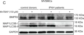 Fig.3.C showing Western Blotting from the publication: MnTBAP Reverses Pulmonary Vascular Remodeling and Improves Cardiac Function in Experimentally Induced Pulmonary Arterial Hypertension.
