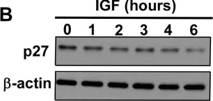 Fig.5.B showing Western Blotting in a Mus musculus (House mouse) sample from the publication: Doxycycline regulated induction of AKT in murine prostate drives proliferation independently of p27 cyclin dependent kinase inhibitor downregulation.