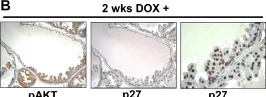 Fig.4.B showing Immunohistochemistry in a Mus musculus (House mouse) sample from the publication: Doxycycline regulated induction of AKT in murine prostate drives proliferation independently of p27 cyclin dependent kinase inhibitor downregulation.