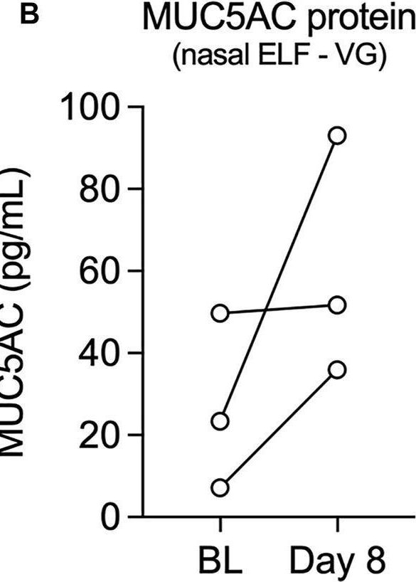Fig.3.B showing Enzyme-linked immunosorbent assay from the publication: Vegetable glycerin e-cigarette aerosols cause airway inflammation and ion channel dysfunction.