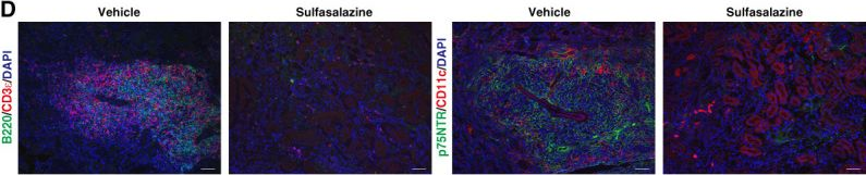 Fig.4.D showing Immunohistochemistry-immunofluorescence from the publication: Glutathione Synthesis via the Cystine/Glutamate Transporter Promotes the Formation of Tertiary Lymphoid Structures in the Kidney.