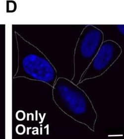 Fig.5.D showing Immunocytochemistry-immunofluorescence from the publication: Regulation of store-operated Ca2+ entry by IP3 receptors independent of their ability to release Ca2.