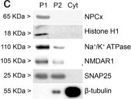 Fig.6.C showing Western Blotting from the publication: Fit-for-purpose based testing and validation of antibodies to amino- and carboxy-terminal domains of cannabinoid receptor 1.