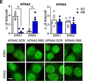 Fig.4.E showing Immunocytochemistry-immunofluorescence in a Mus musculus (House mouse) sample from the publication: Nuclear ERK1/2 signaling potentiation enhances neuroprotection and cognition via Importinα1/KPNA2.