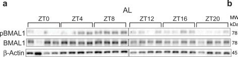 Fig.9.A showing Western Blotting from the publication: Time-restricted feeding normalizes hyperinsulinemia to inhibit breast cancer in obese postmenopausal mouse models.