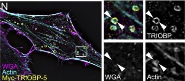 Fig.2.N showing Immunohistochemistry-immunofluorescence from the publication: ANKRD24 organizes TRIOBP to reinforce stereocilia insertion points.