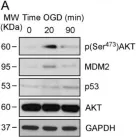 Fig.1.A showing Western Blotting from the publication: Preconditioning-Activated AKT Controls Neuronal Tolerance to Ischemia through the MDM2-p53 Pathway.