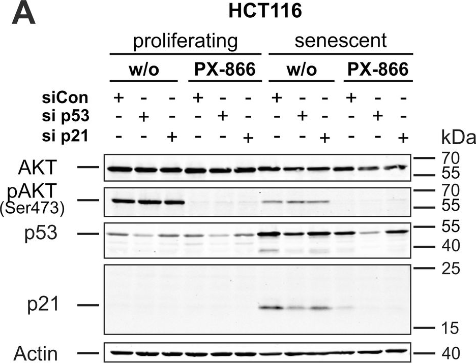 Fig.6.A showing Western Blotting from the publication: Combined inhibition of class 1-PI3K-alpha and delta isoforms causes senolysis by inducing p21WAF1/CIP1 proteasomal degradation in senescent cells.