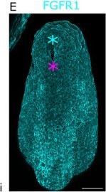 Fig.2.E showing Immunohistochemistry-immunofluorescence from the publication: Caudal Fgfr1 disruption produces localised spinal mis-patterning and a terminal myelocystocele-like phenotype in mice.