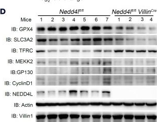 Fig.5.D showing Western Blotting from the publication: NEDD4L mediates intestinal epithelial cell ferroptosis to restrict inflammatory bowel diseases and colorectal tumorigenesis.