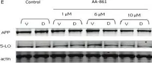 Fig.3.E showing Western Blotting from the publication: Involvement of 5-lipoxygenase in the corticosteroid-dependent amyloid beta formation: in vitro and in vivo evidence.