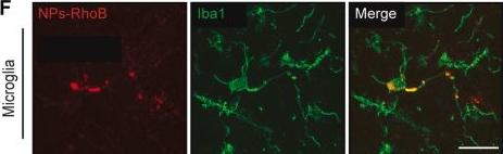 Fig.5.F showing Immunohistochemistry-immunofluorescence in a Rattus norvegicus (Rat) sample from the publication: Targeted PPARδ activation reprograms microglial immunometabolism and improves insulin sensitivity in HFD-fed rats.