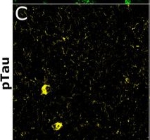 AT8 antibodies - Antibody search engine - CiteAb