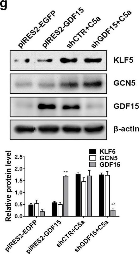 Fig.3.G showing Western Blotting in a Homo sapiens (Human) sample from the publication: C5a induces A549 cell proliferation of non-small cell lung cancer via GDF15 gene activation mediated by GCN5-dependent KLF5 acetylation.
