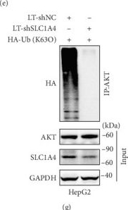 Fig.2.E showing Western Blotting in a Homo sapiens (Human) sample from the publication: SLC1A4 Promotes Malignant Transformation of Hepatocellular Carcinoma by Activating the AKT Signaling.