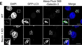 Fig.3.E showing Immunocytochemistry-immunofluorescence from the publication: Bcl-xL Affects Group A Streptococcus-Induced Autophagy Directly, by Inhibiting Fusion between Autophagosomes and Lysosomes, and Indirectly, by Inhibiting Bacterial Internalization via Interaction with Beclin 1-UVRAG.