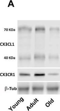 Fig.2.A showing Western Blotting from the publication: Age-Related Changes in Neuron-Microglia Interaction Mediated by Fractalkine Under Inflammatory Conditions.