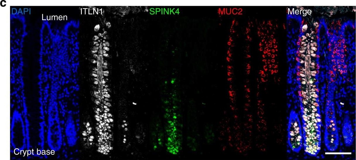 Fig.4.C showing Immunohistochemistry-immunofluorescence in a Homo sapiens (Human) sample from the publication: Single cell RNA-seq reveals profound transcriptional similarity between Barrett's oesophagus and oesophageal submucosal glands.