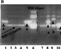 Fig.2.B from the publication: The effect of radiofrequency heat treatment on trypsin inhibitor activity and in vitro digestibility of soybean varieties (Glycine max. (L.) Merr.).