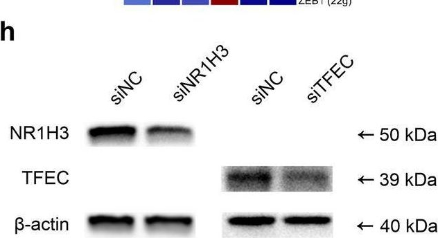 Fig.3.H showing Western Blotting in a Homo sapiens (Human) sample from the publication: Single-cell transcriptomics reveals regulators underlying immune cell diversity and immune subtypes associated with prognosis in nasopharyngeal carcinoma.