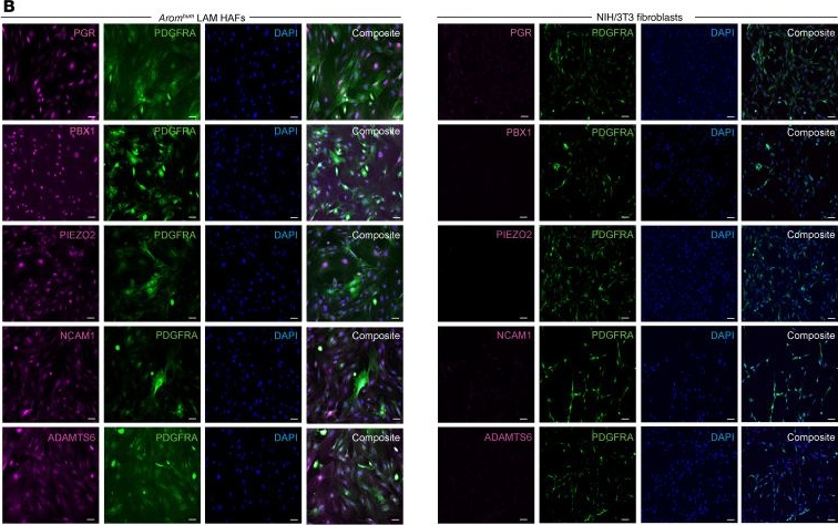 Fig.4.B showing Immunocytochemistry-immunofluorescence in a Mus musculus (House mouse) sample from the publication: Estrogen receptor-α ablation reverses muscle fibrosis and inguinal hernias.