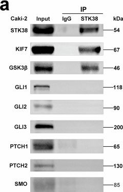Fig.3.A showing Western Blotting from the publication: STK38-mediated feedback loop regulation of the hedgehog pathway governing tumor heterogeneity in renal papillary carcinoma.