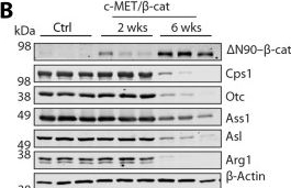 Fig.2.B showing Western Blotting in a Mus musculus (House mouse) sample from the publication: Impaired nitrogenous waste clearance promotes hepatocellular carcinoma.