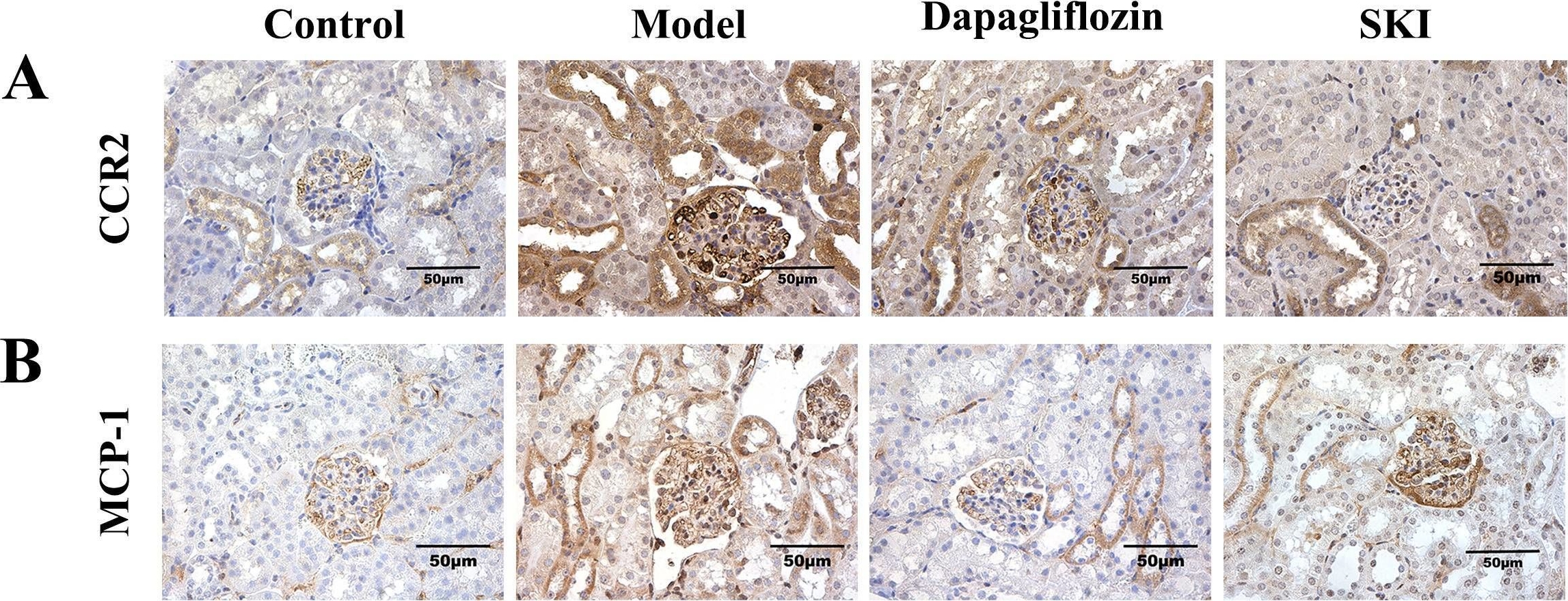 Fig.3.A showing Immunohistochemistry in a Mus musculus (House mouse) sample from the publication: Protective effects of Shenkang injection against diabetic kidney disease via p38 MAPK/NFκB/MCP-1/CCR2 pathway inhibition.