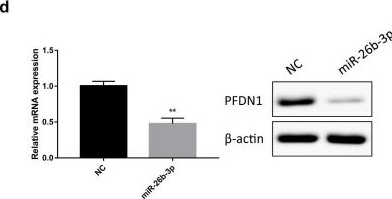 Fig.3.D showing Western Blotting in a Homo sapiens (Human) sample from the publication: Functional Passenger-Strand miRNAs in Exosomes Derived from Human Colon Cancer Cells and Their Heterogeneous Paracrine Effects.