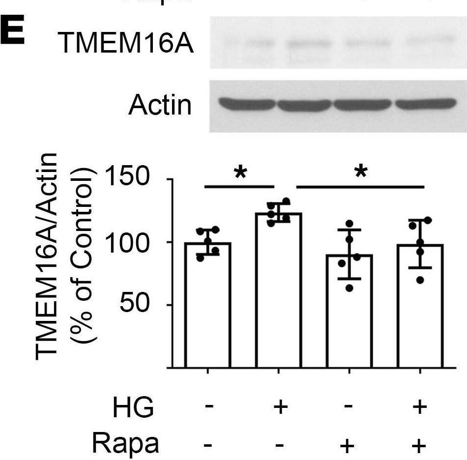 Fig.5.M showing Western Blotting from the publication: The CLCA1/TMEM16A/Cl- current axis associates with H2S deficiency in diabetic kidney injury.