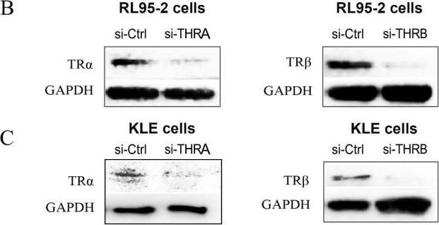 Fig.3.B showing Western Blotting in a Homo sapiens (Human) sample from the publication: Thyroid Hormone Receptor β Knockdown Reduces Suppression of Progestins by Activating the mTOR Pathway in Endometrial Cancer Cells.