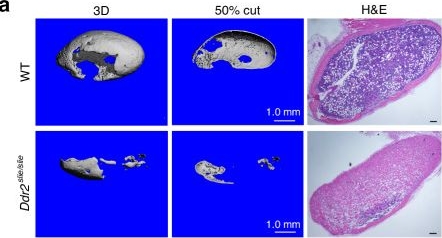 Fig.1.A showing Immunohistochemistry in a Mus musculus (House mouse) sample from the publication: Discoidin domain receptor 2 is an important modulator of BMP signaling during heterotopic bone formation.
