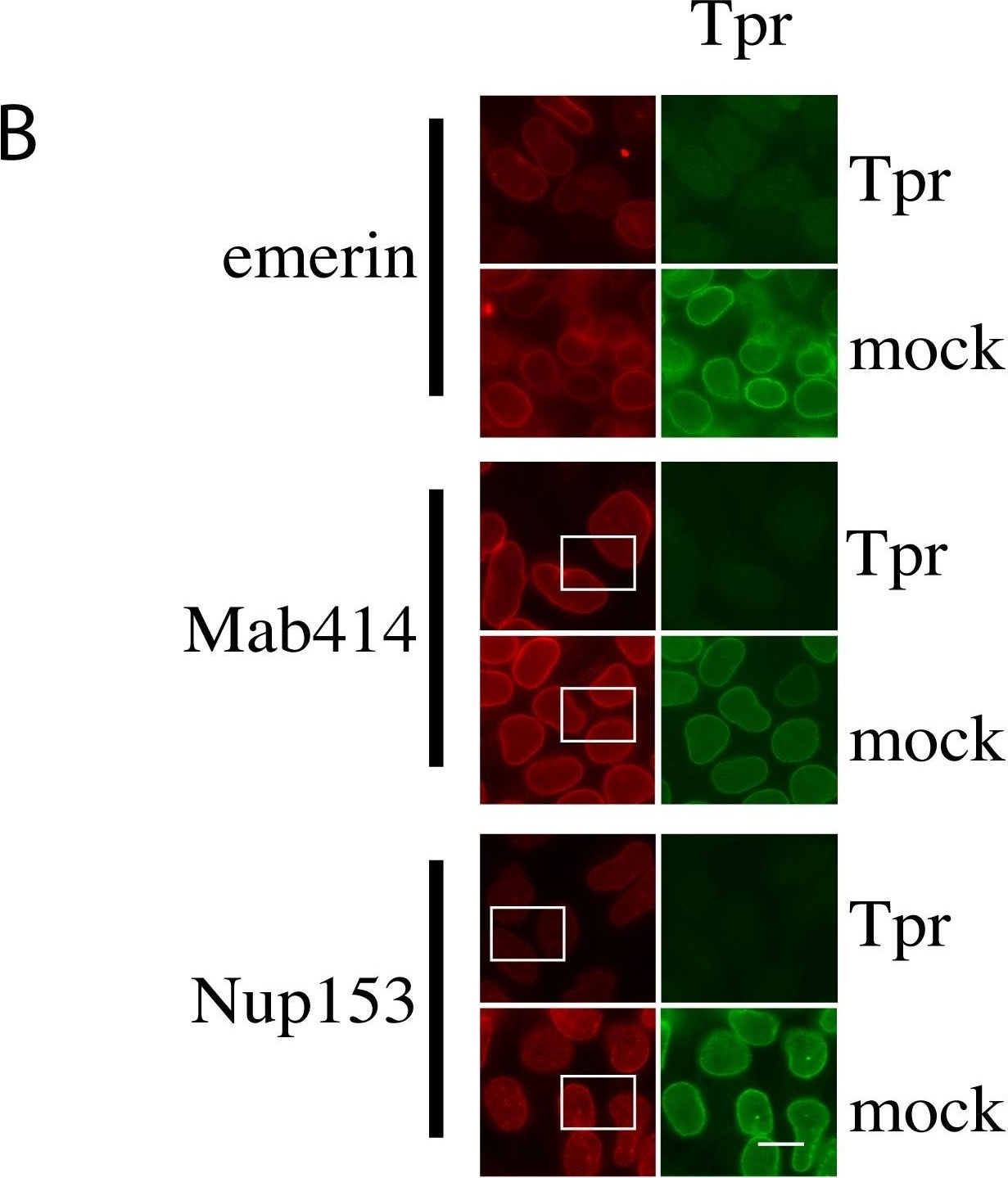 Silencing nuclear pore protein Tpr elicits a senescent-like phenotype in cancer cells.