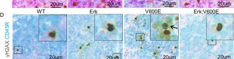 Fig.4.D showing Immunohistochemistry in a Mus musculus (House mouse) sample from the publication: Differential contribution for ERK1 and ERK2 kinases in BRAFV600E-triggered phenotypes in adult mouse models.