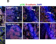 Fig.4.D showing Immunohistochemistry-immunofluorescence in a Mus musculus (House mouse) sample from the publication: Lack of transforming growth factor-β signaling promotes collective cancer cell invasion through tumor-stromal crosstalk.