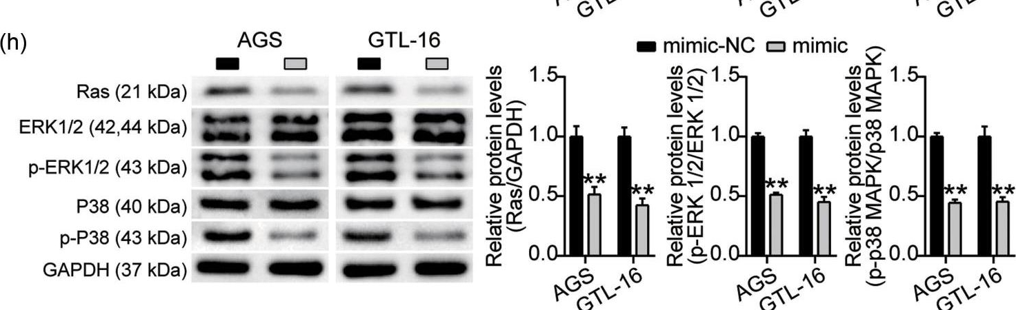 Fig.1.H showing Western Blotting from the publication: MiR-1278 targets CALD1 and suppresses the progression of gastric cancer via the MAPK pathway.