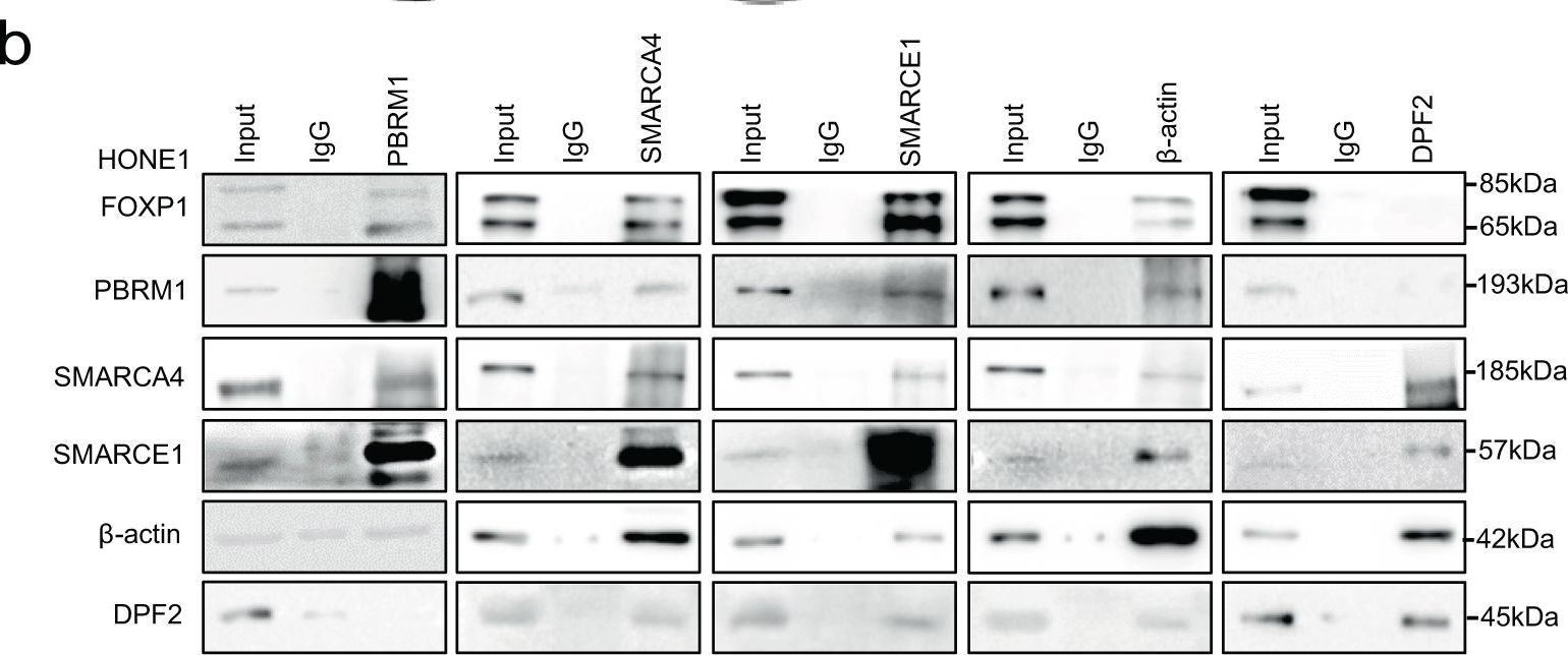 Fig.6.B showing Western Blotting in a Homo sapiens (Human) sample from the publication: EBV miRNAs BART11 and BART17-3p promote immune escape through the enhancer-mediated transcription of PD-L1.