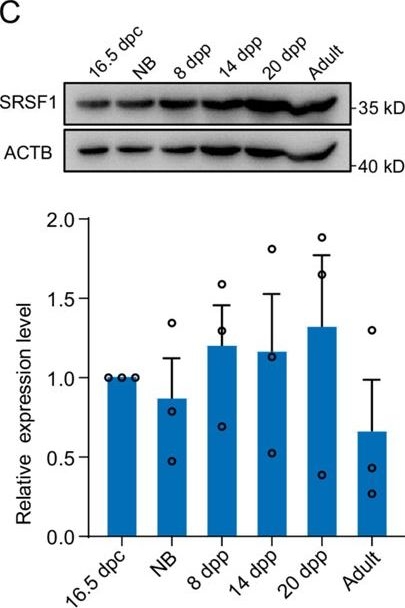 Fig.1.C showing Western Blotting in a Mus musculus (House mouse) sample from the publication: Splicing factor SRSF1 is essential for homing of precursor spermatogonial stem cells in mice.