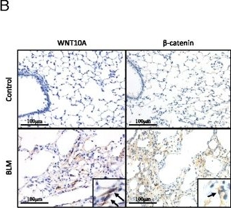 Fig.4.B showing Immunohistochemistry in a Mus musculus (House mouse) sample from the publication: Profibrotic role of WNT10A via TGF-β signaling in idiopathic pulmonary fibrosis.