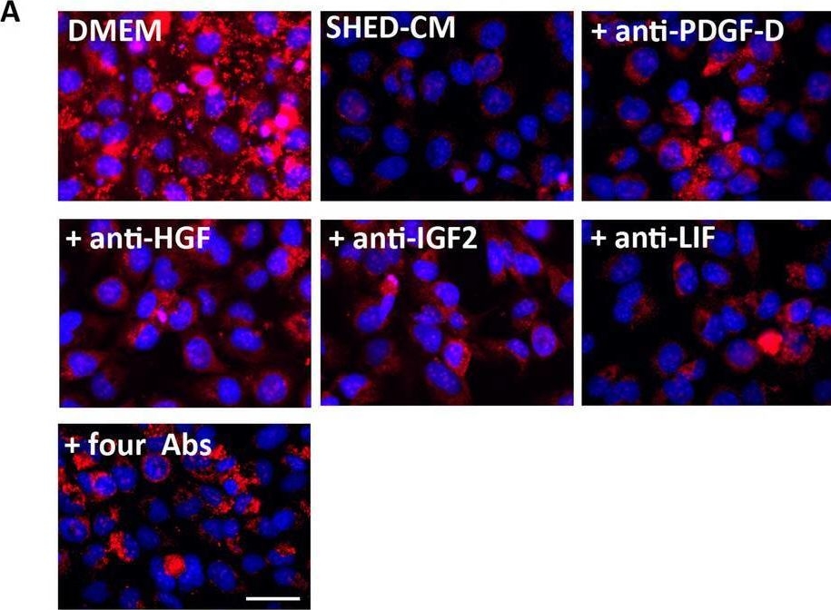 Fig.9.A showing Immunocytochemistry-immunofluorescence in a Homo sapiens (Human) sample from the publication: Therapeutic benefits of factors derived from stem cells from human exfoliated deciduous teeth for radiation-induced mouse xerostomia.