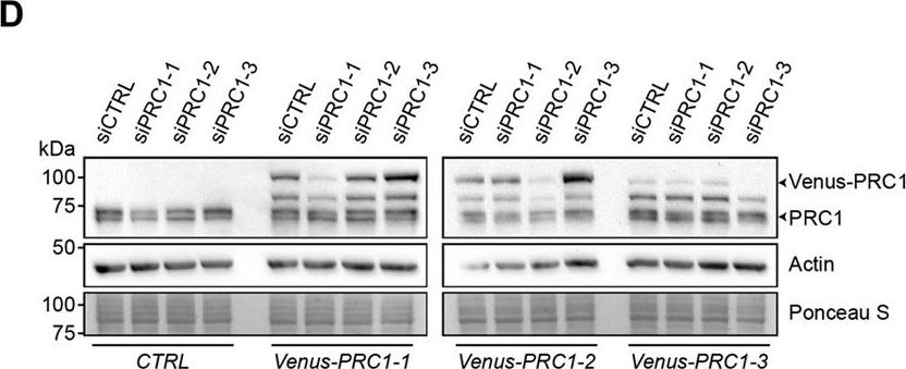 Fig.2.D showing Western Blotting in a Homo sapiens (Human) sample from the publication: The lethal response to Cdk1 inhibition depends on sister chromatid alignment errors generated by KIF4 and isoform 1 of PRC1.