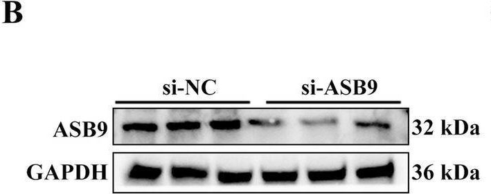 Fig.6.B showing Western Blotting from the publication: CLOCK inhibits the proliferation of porcine ovarian granulosa cells by targeting ASB9.