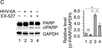 Fig.6.C showing Western Blotting in a Homo sapiens (Human) sample from the publication: HHV-6A Drives Epigenetic Reprogramming via an EZH2-SIRT1 Axis to Sustain Mutant p53 and Reshape Oncogenic Inflammatory Signaling.