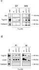 Fig.3.C,D showing Western Blotting in a Homo sapiens (Human) sample from the publication: Acidic microenvironment plays a key role in human melanoma progression through a sustained exosome mediated transfer of clinically relevant metastatic molecules.