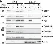 Fig.4.B showing Western Blotting in a Homo sapiens (Human) sample from the publication: 24(S)-Hydroxycholesterol induces ER dysfunction-mediated unconventional cell death.