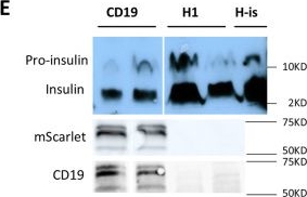 Fig.1.E showing Western Blotting from the publication: Truncated CD19 as a selection marker for the isolation of stem cell-derived β-cells.