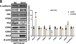 Fig.4.B showing Western Blotting from the publication: AVL9 promotes colorectal carcinoma cell migration via regulating EGFR expression.